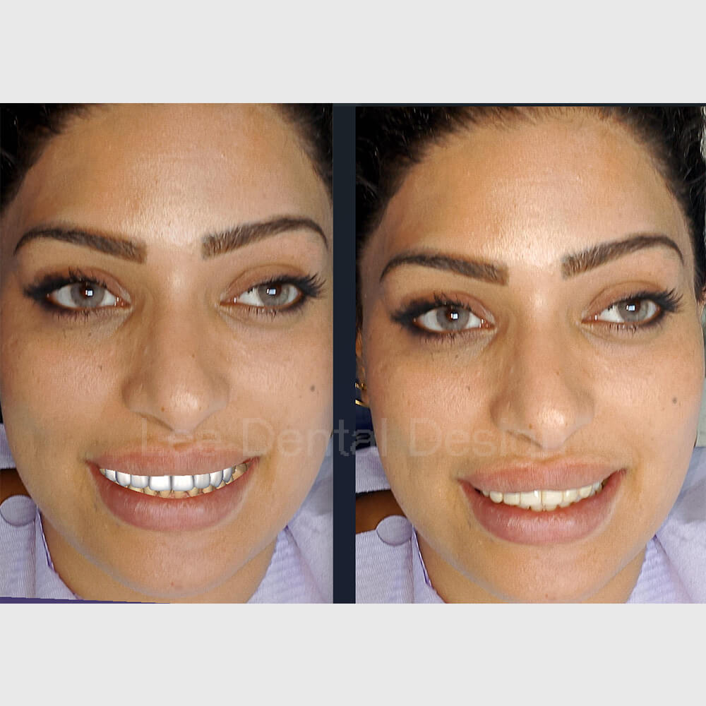 DSD Smile Design 8