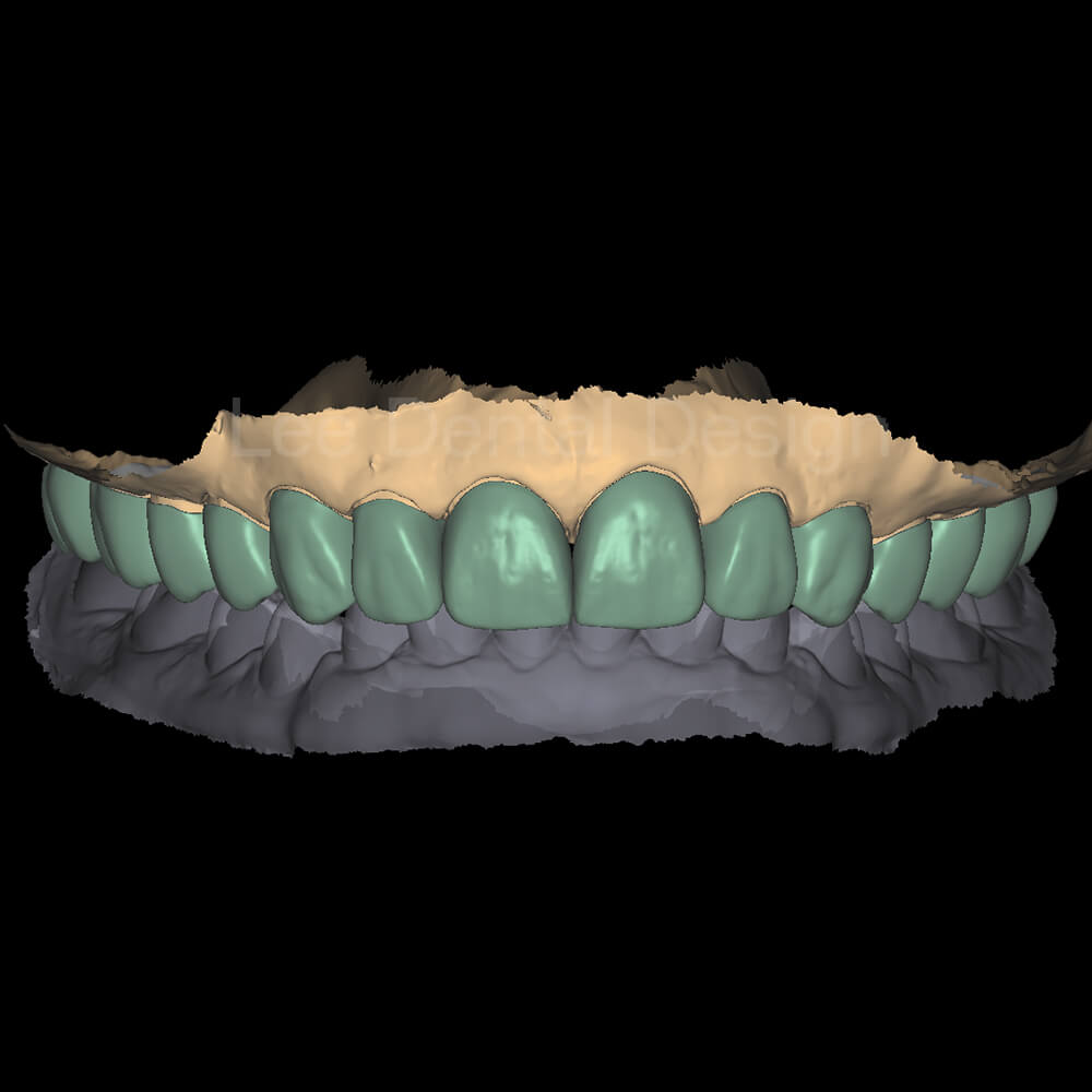 DSD Smile Design 6