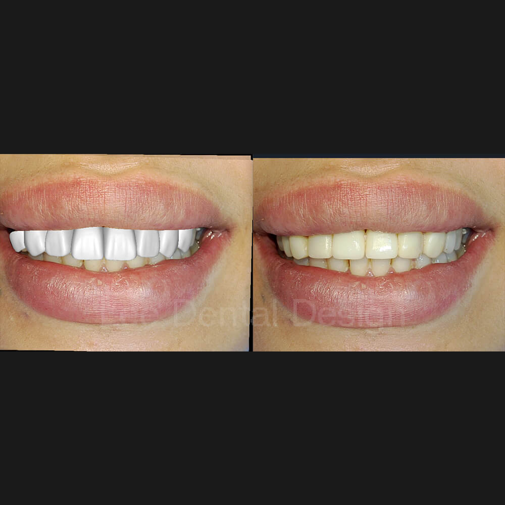 DSD Smile Design 12