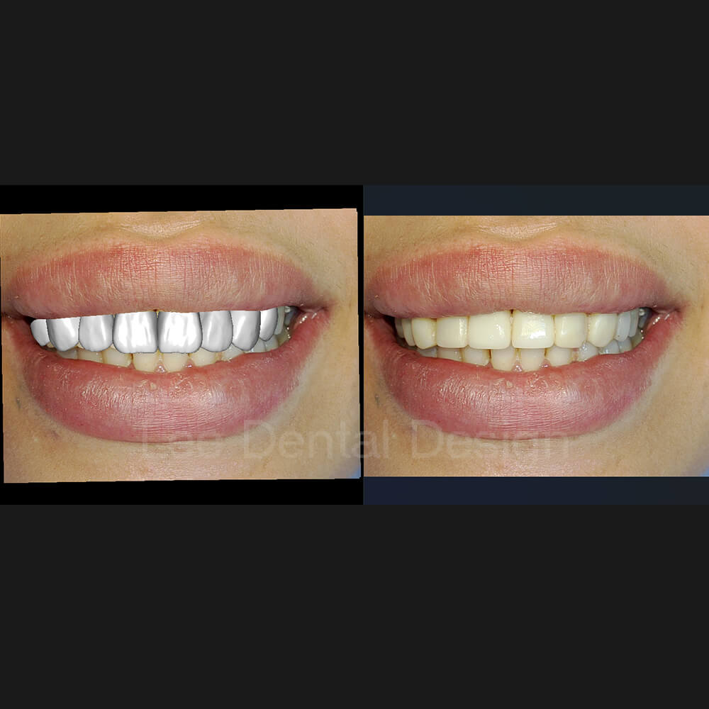 DSD Smile Design 9