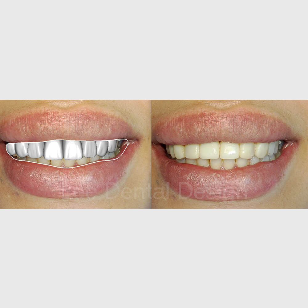 DSD Smile Design 7