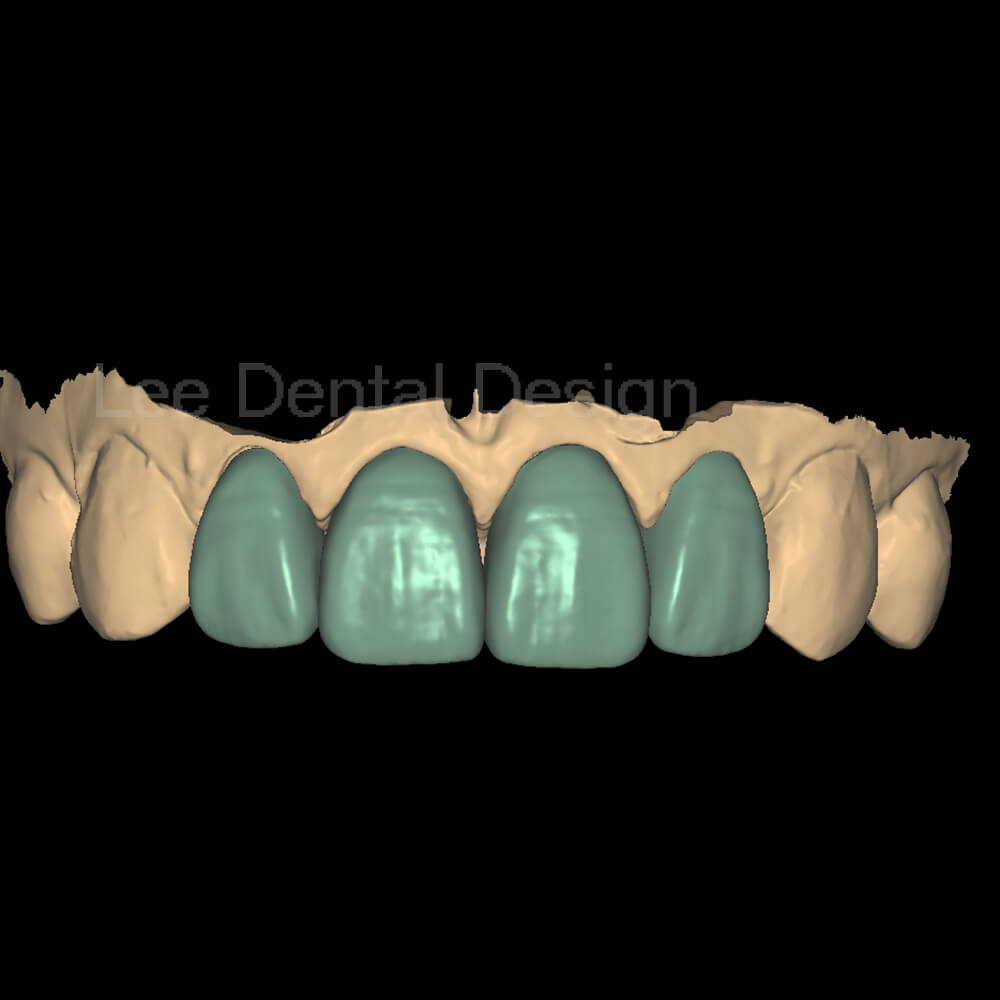DSD Smile Design 3