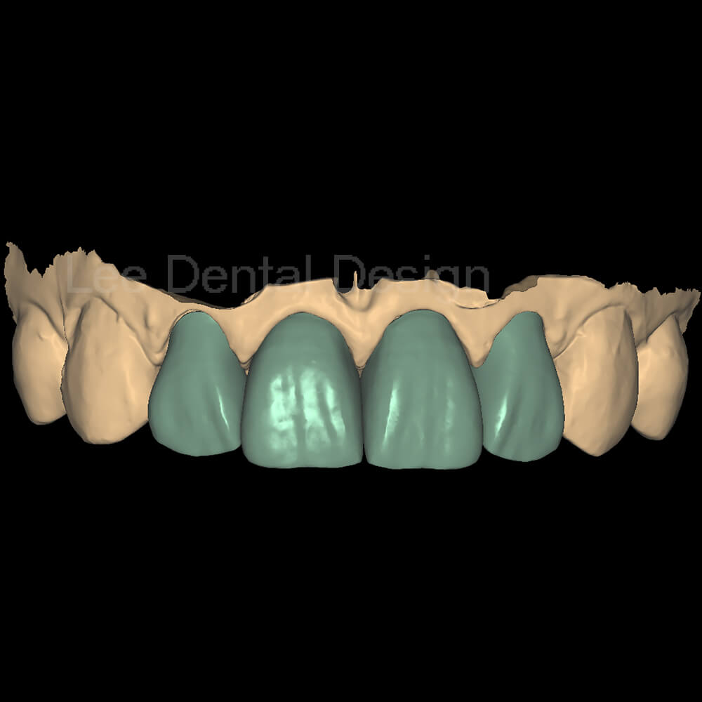 DSD Smile Design 2