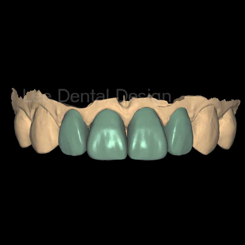 DSD Smile Design 1