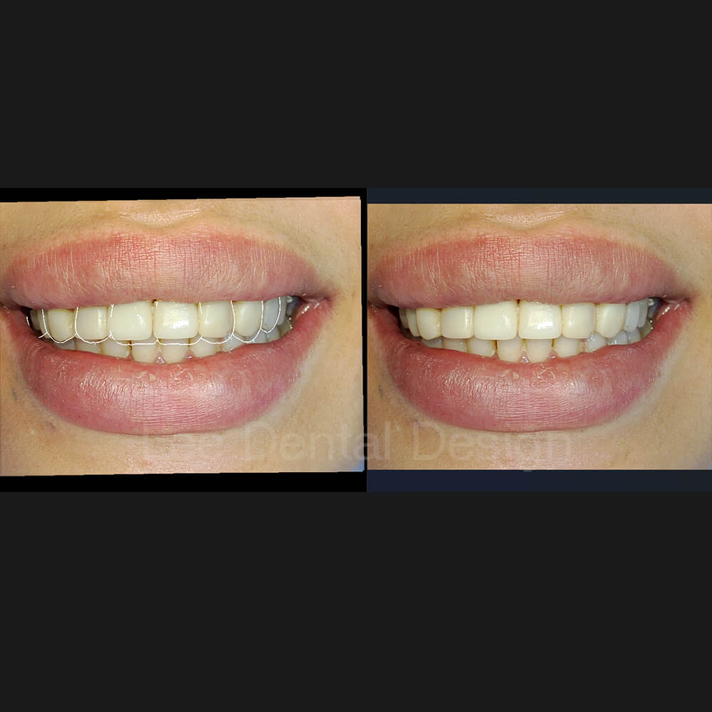 DSD Smile Design 11