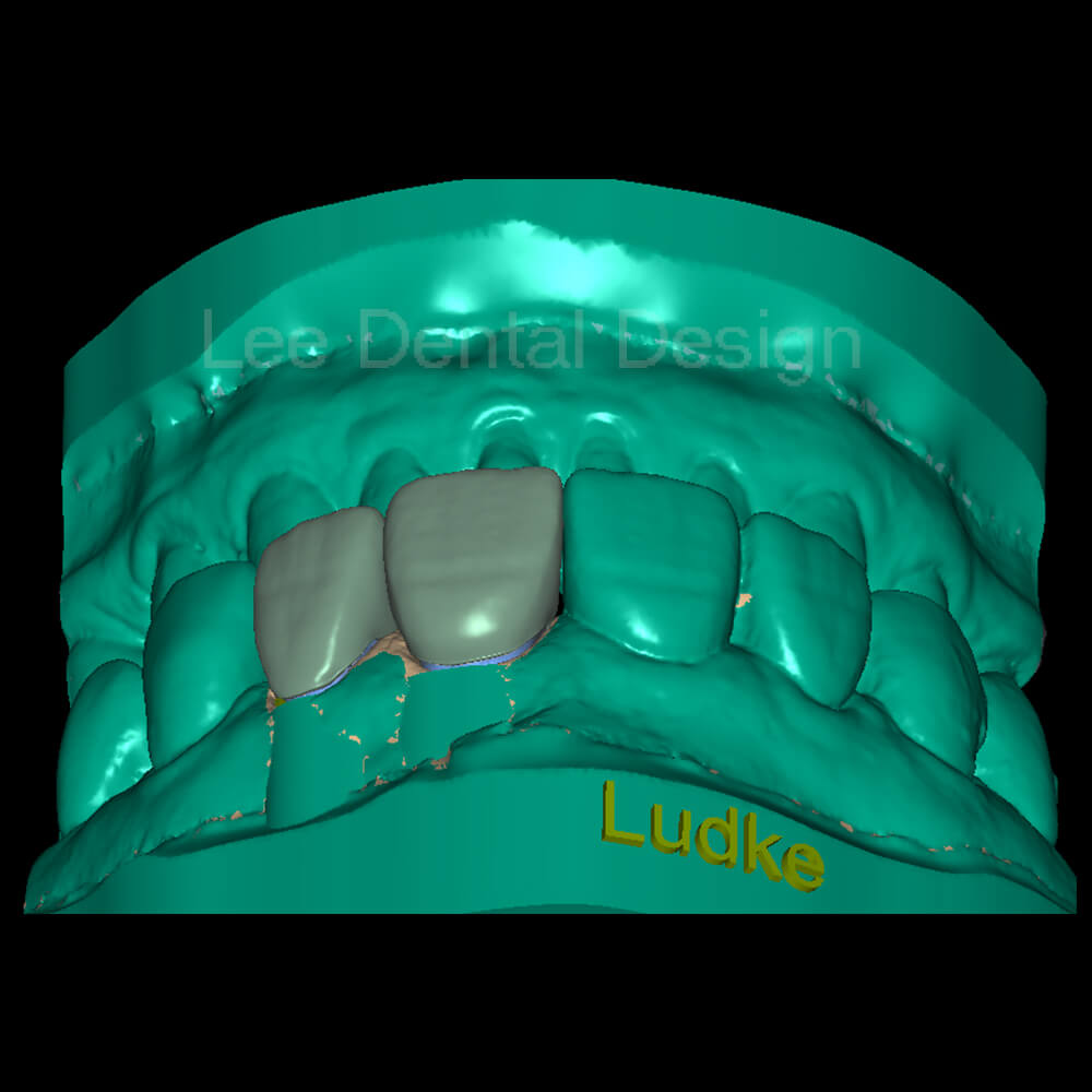 DSD Smile Design 4