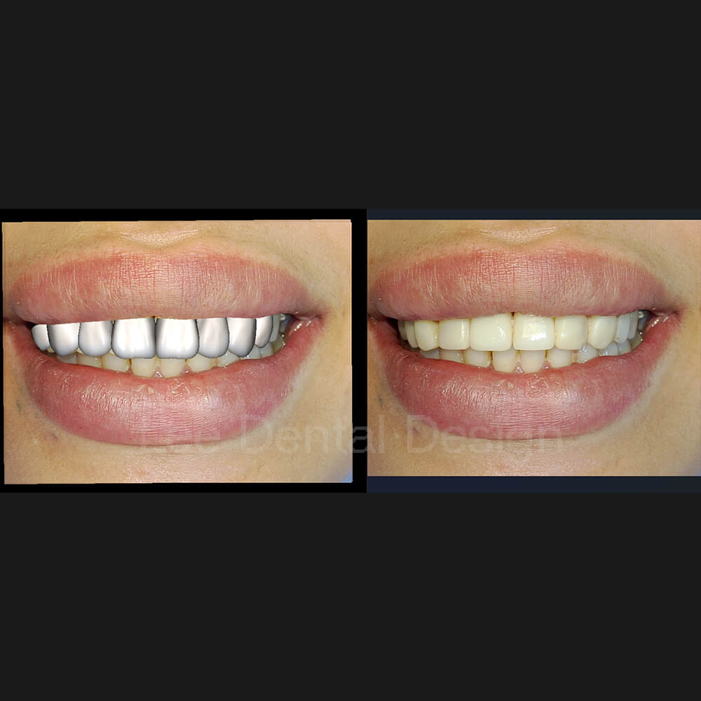 DSD Smile Design 13