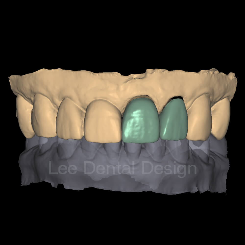 DSD Smile Design 5