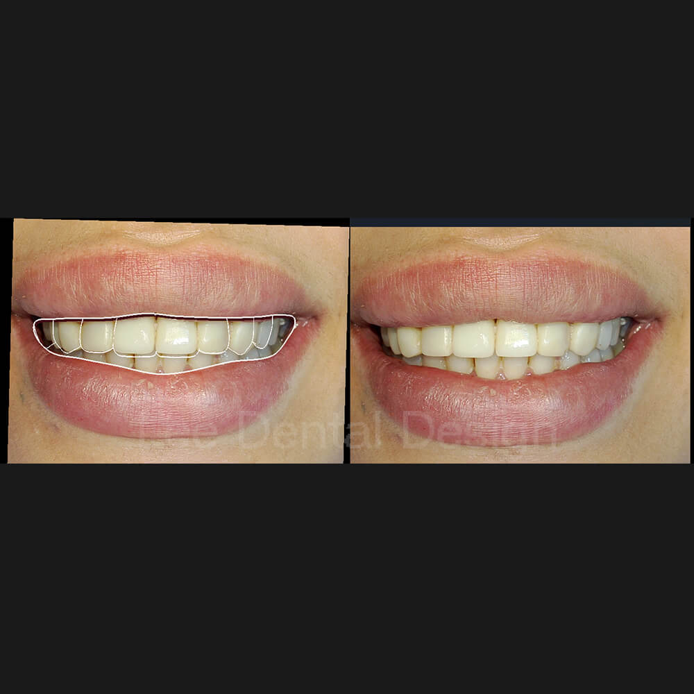 DSD Smile Design 10