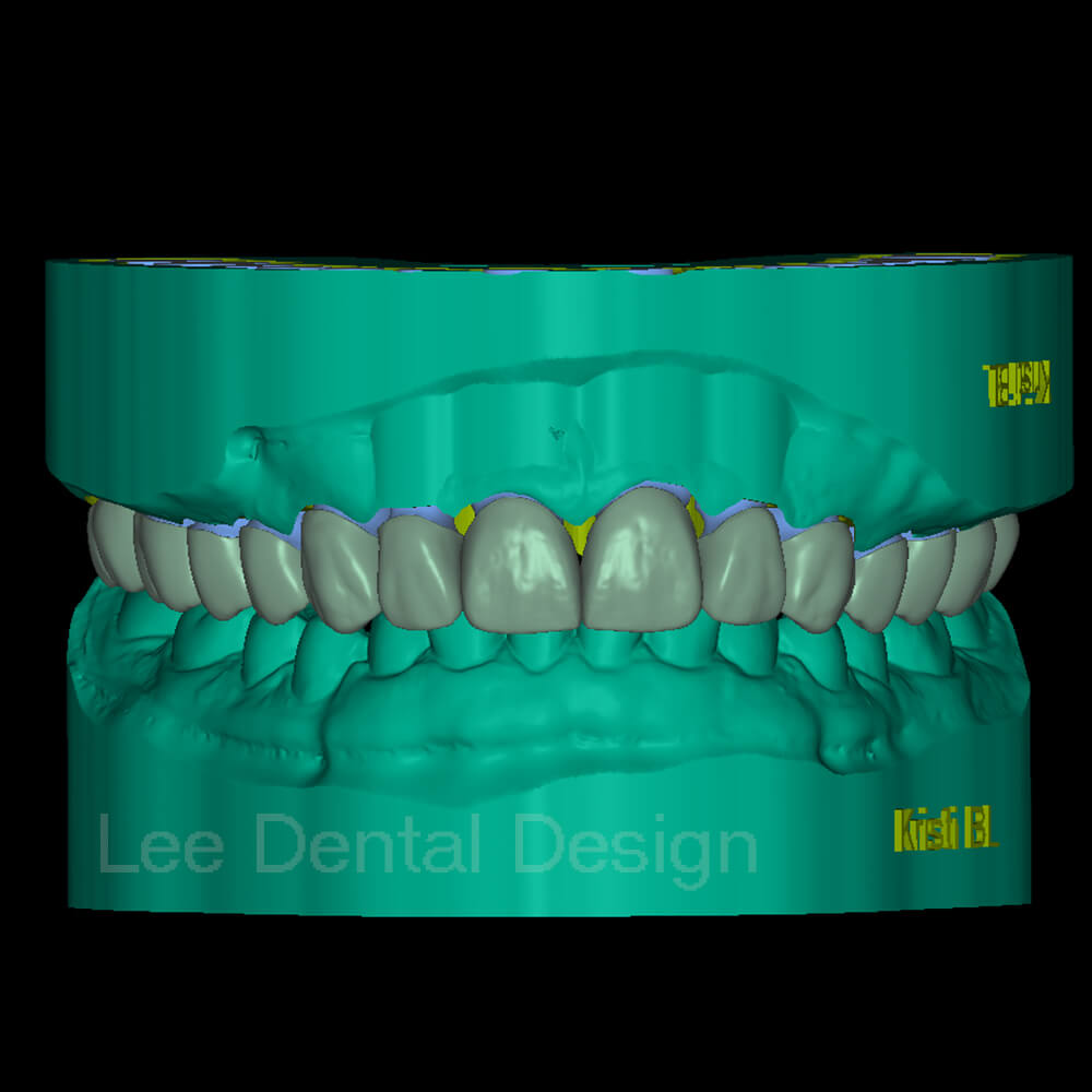 Margin Model Design 3