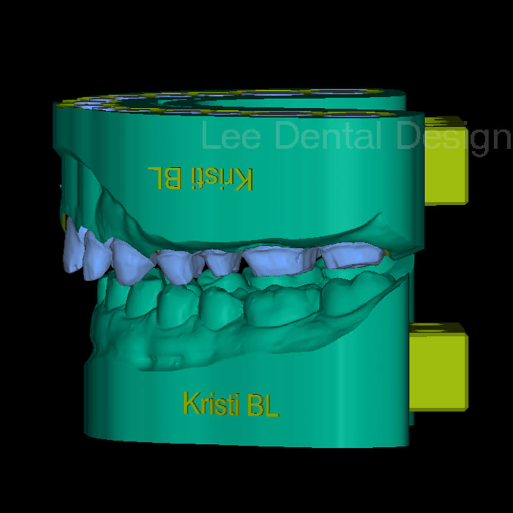 Margin Model Design 4