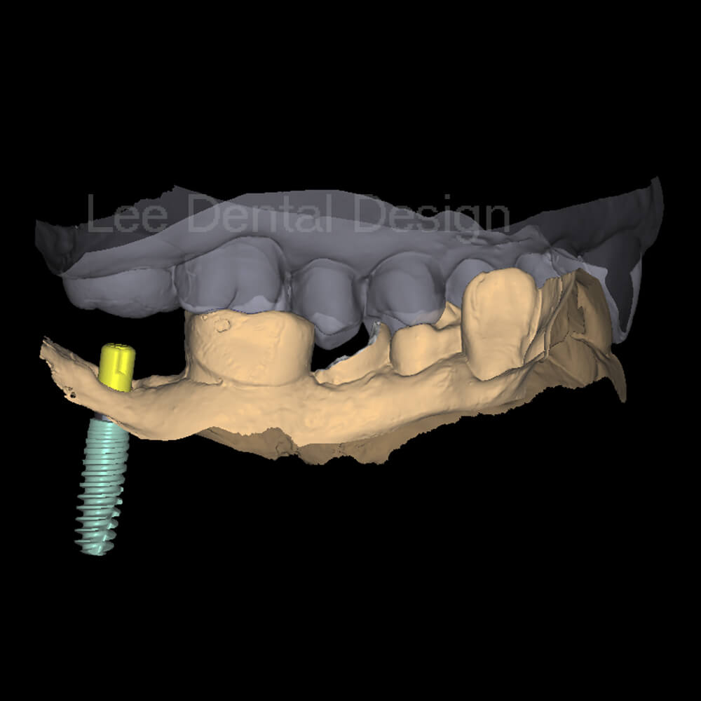 Margin Model Design 2