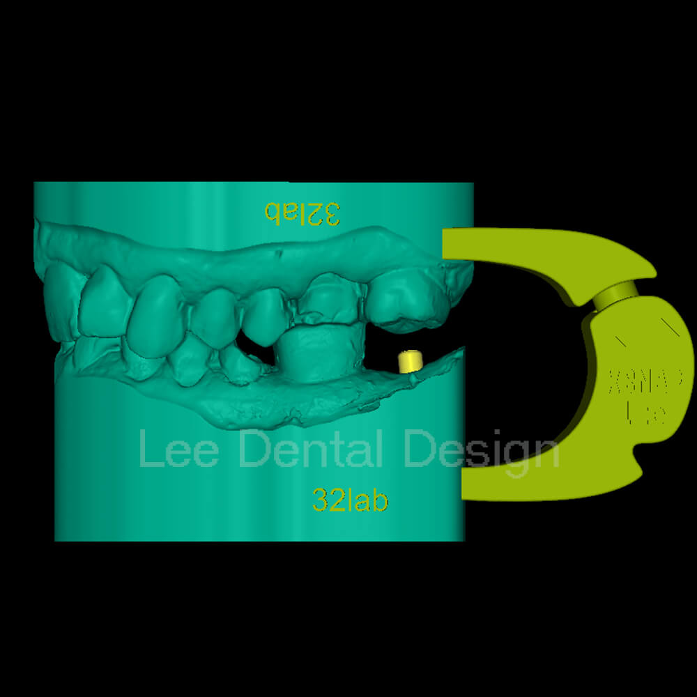 Margin Model Design 1
