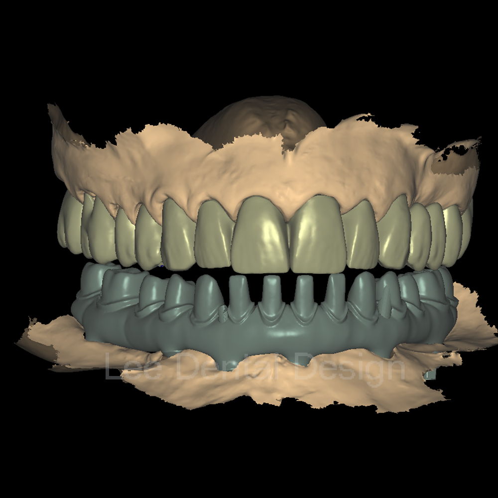 Scientists have developed a new type of bionic denture material